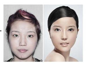 成都医疗整形爆料事件最新,揭秘行业乱象，患者权益如何保障？